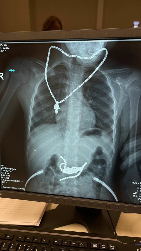 Рентген.jpg