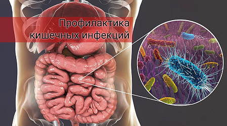 Профилактика кишечных инфекций.
